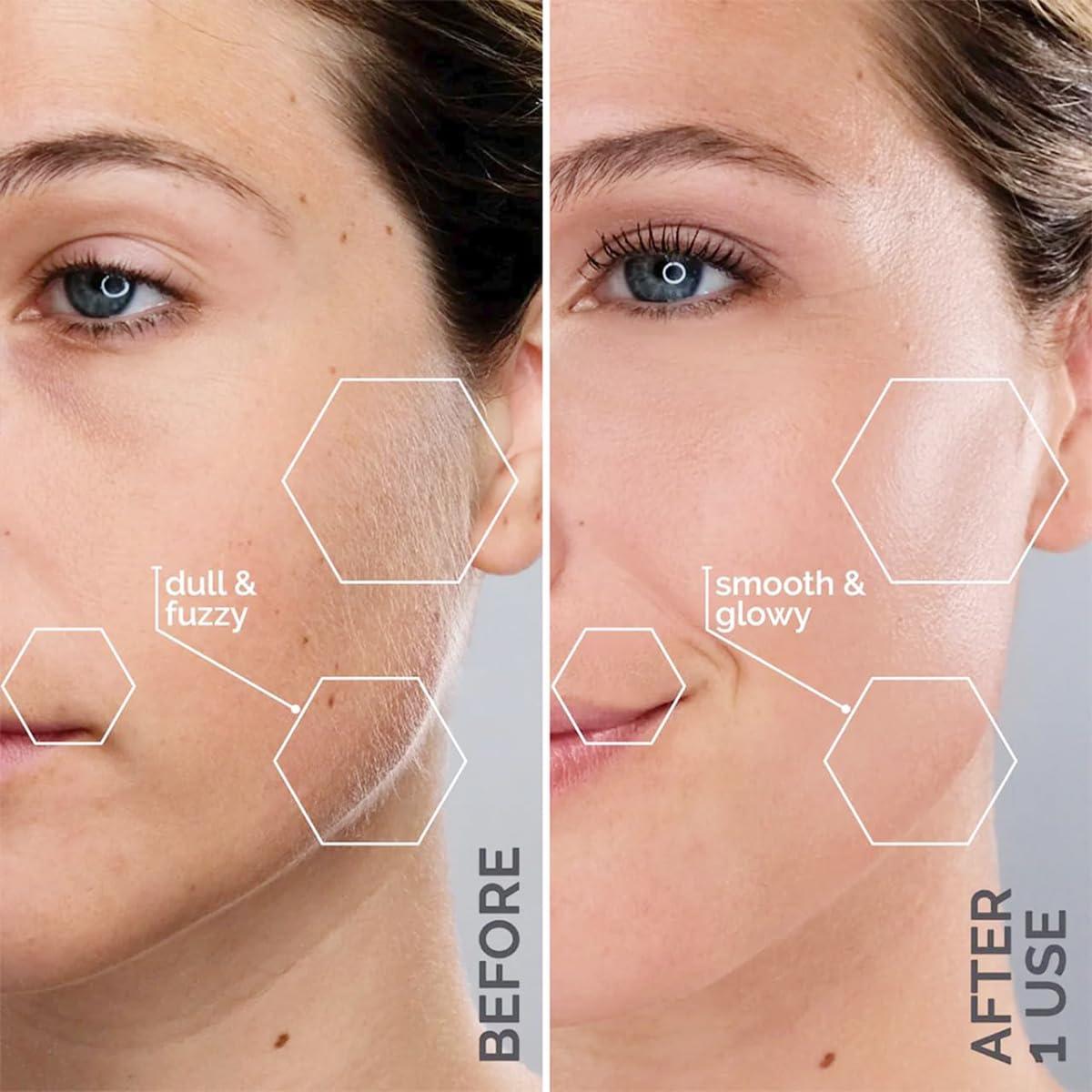 Why We Love the Michael Todd Sonicsmooth Dermaplane Razor