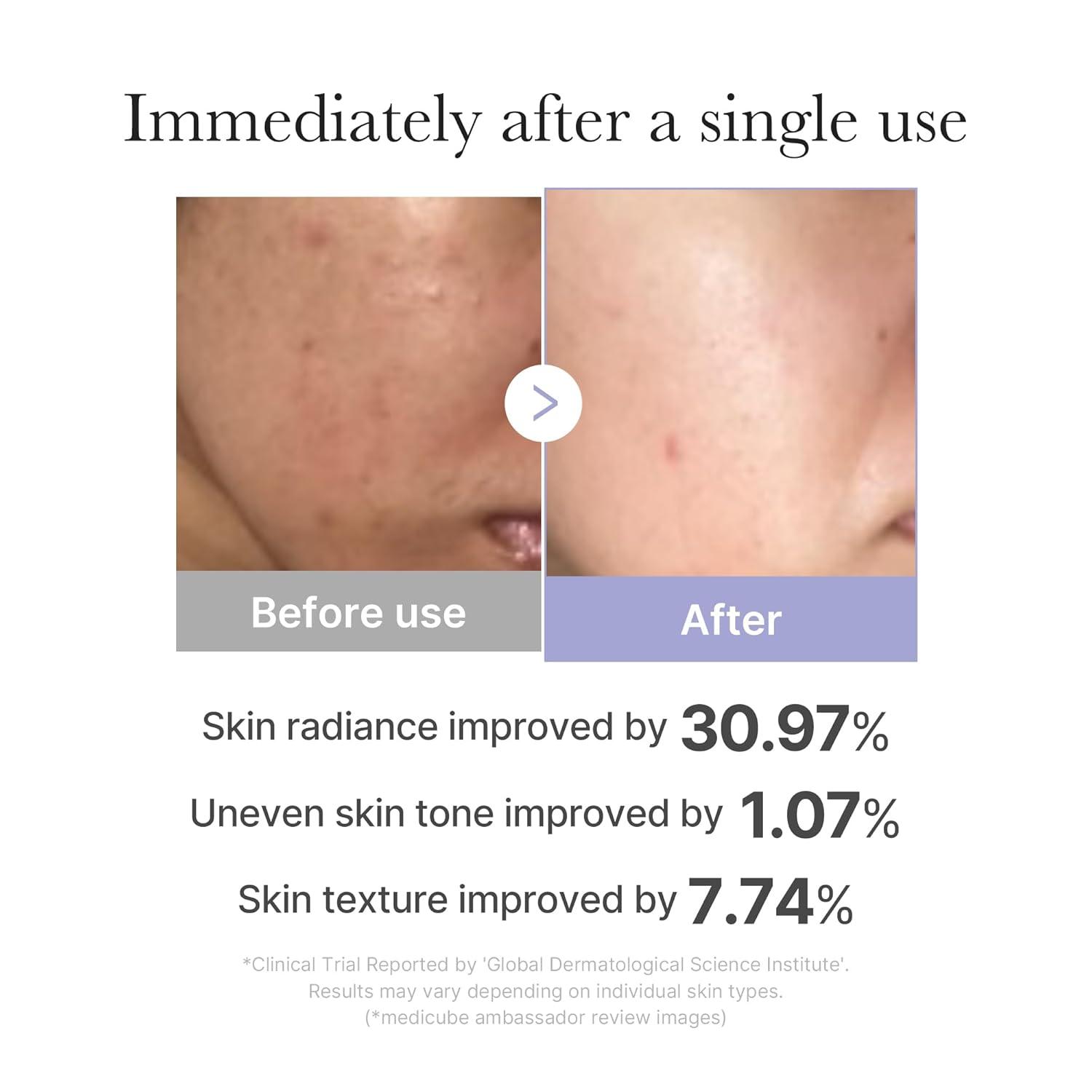 Our‌ Honest Review of Medicube⁢ Mini Booster Pro: Affordable & Effective Glow ‌Tool